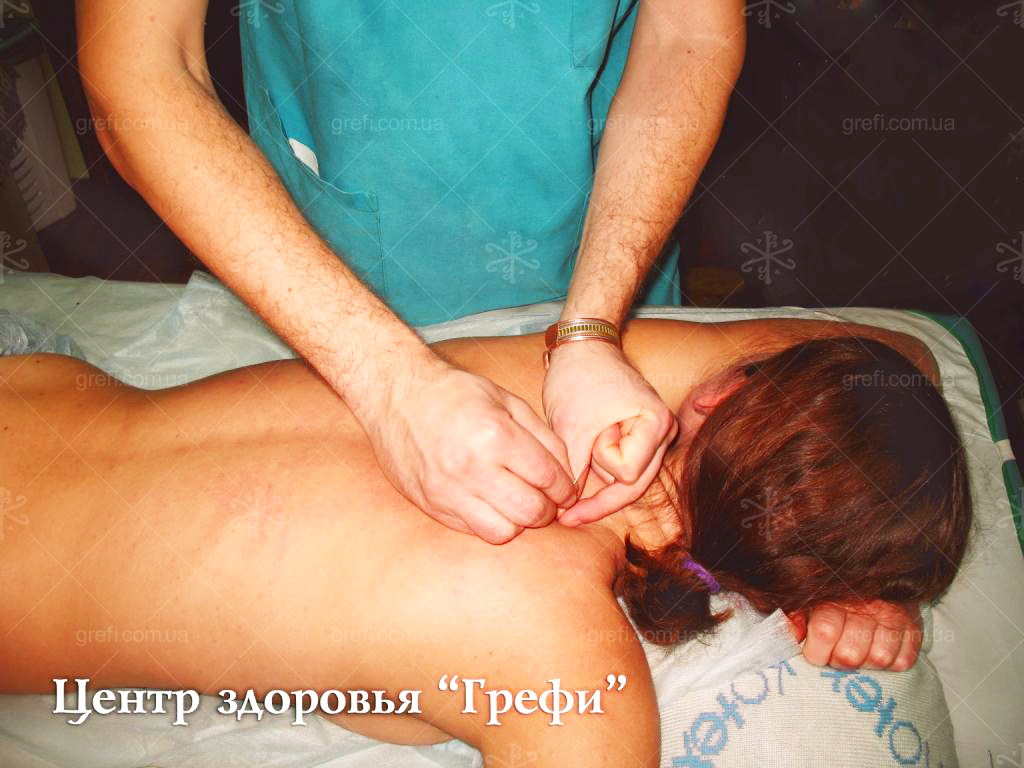 РЕФЛЕКСОТЕРАПИЯ, ИГЛОУКАЛЫВАНИЕ