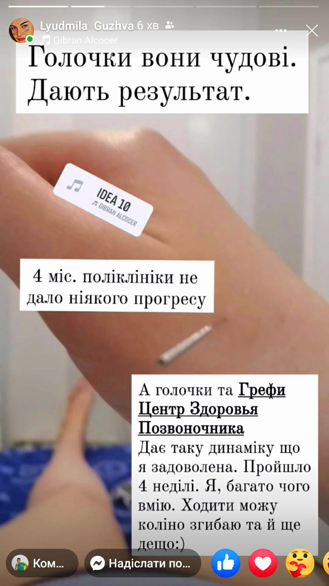 Голковколювання Грефі Запоріжжя відгук